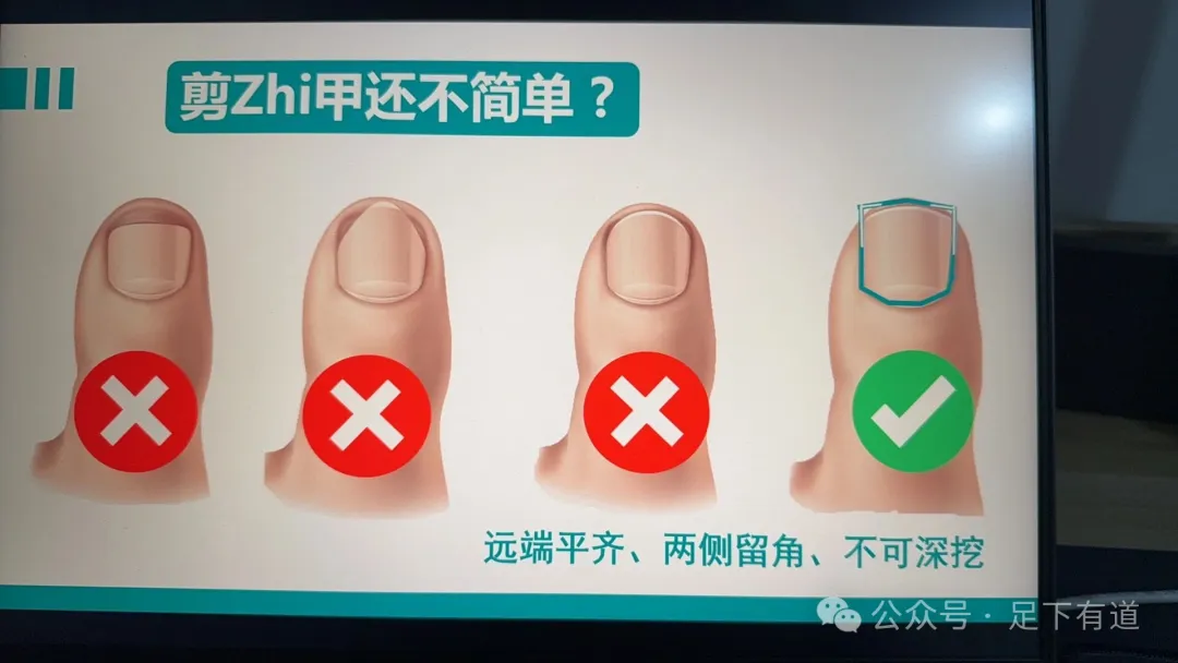 图片|515