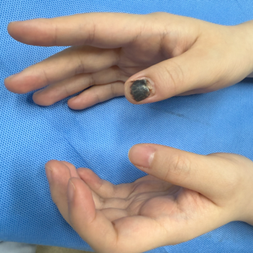 retronychia_thumb